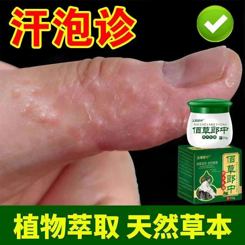 手上起小水泡止痒膏脱皮抑菌汗诊泡克星手指缝痒干裂专用草本乳膏