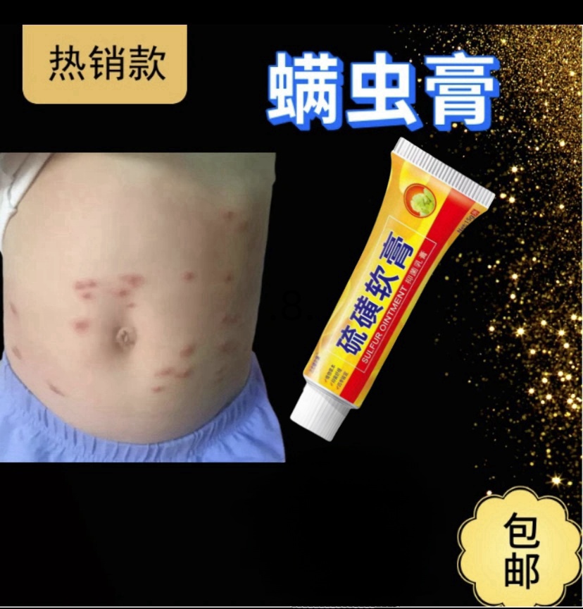 止痒除螨膏外用皮肤瘙痒止痒抑菌止痒膏正品蚊虫叮咬臭虫螨虫