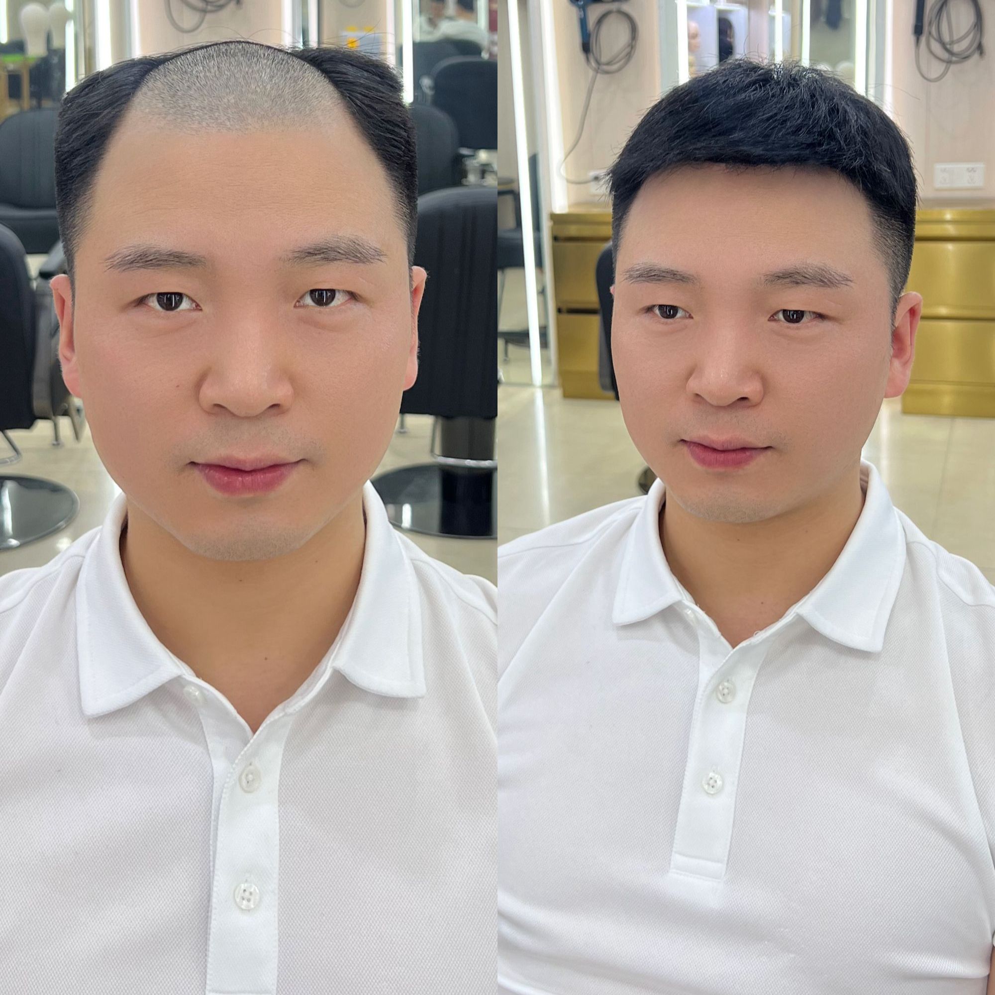 男士假发短发自然真发头顶假发片增发量遮秃顶白发无痕隐形补发片