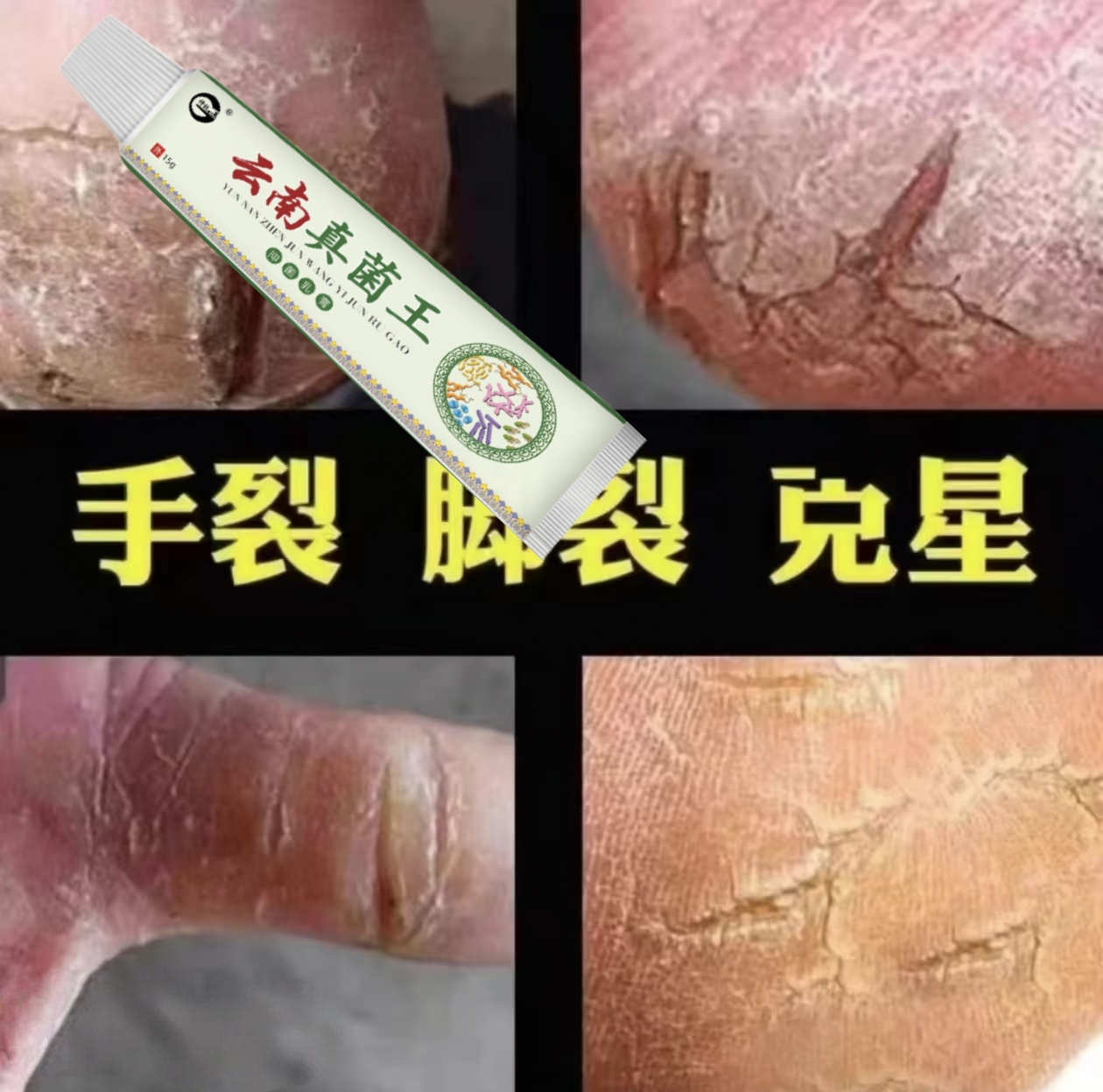 脚后跟干裂粗糙脚底起皮脚痒脚后跟脱皮脚臭抑菌止痒软膏