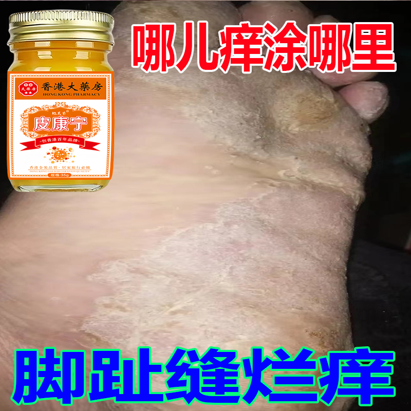 脚趾缝痒专用脚痒脚臭止痒神器脚丫脱皮抑菌膏开裂克星喷雾剂
