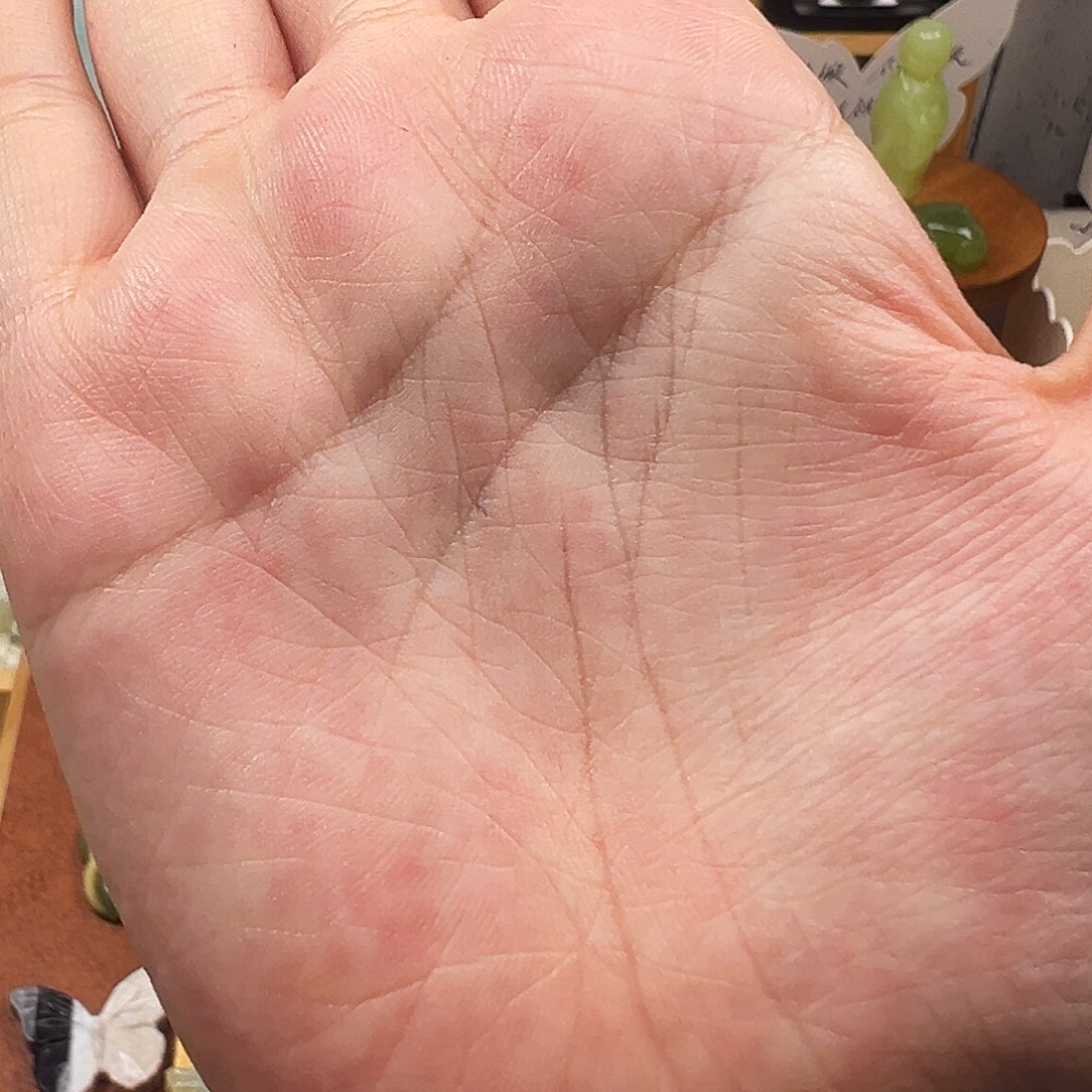 i***u蛇纹石玉合金粉色