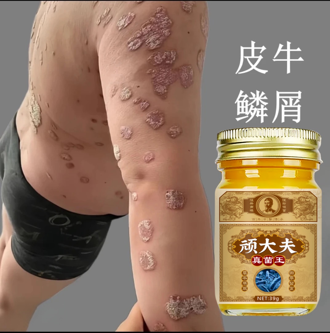 【次日发】顽大夫真菌王植物萃取皮肤抑菌乳膏修护温和乳膏草本清凉