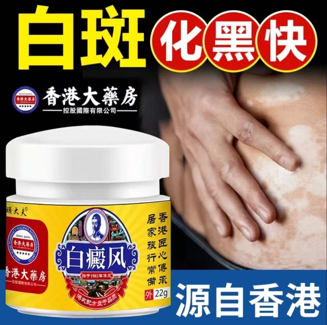 香港白斑外用黑色素生长膏白斑净补骨脂酊膏遮盖白斑净乳膏