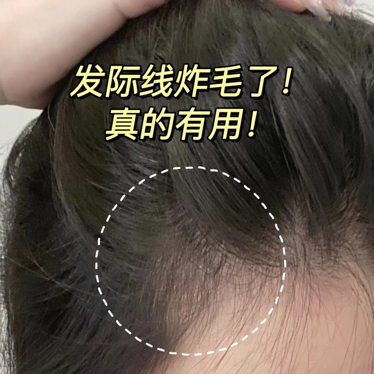 【宠粉！源480！】扁塌小凸凸看过来！粉色瓶元气防脱头皮精华