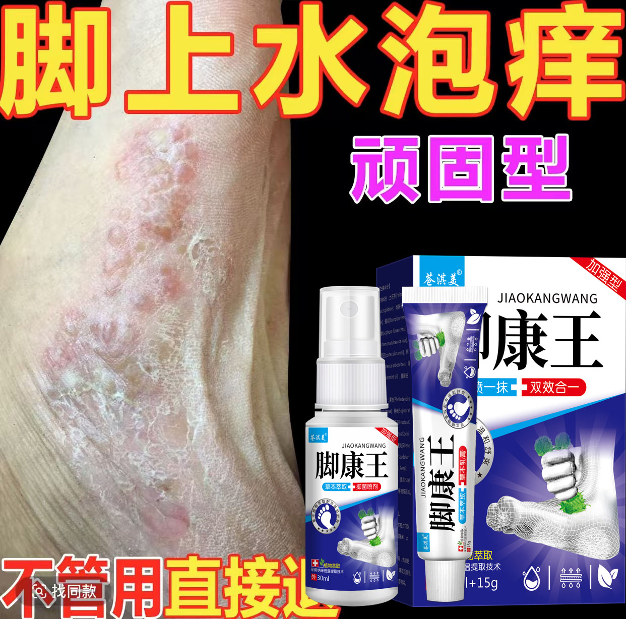 脚底脚上起小水痒泡脱皮脚臭止痒抑菌软膏特效神器克星