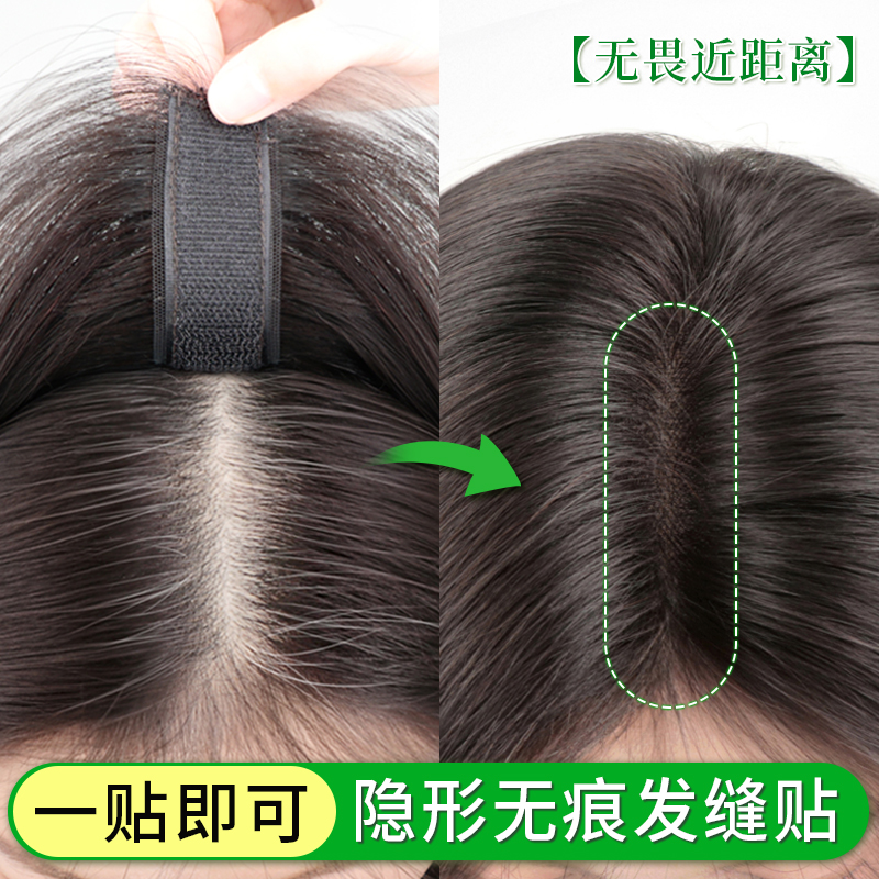 君知否发缝贴假刘海假发片头顶全真发高颅顶一片式自然补发推荐女