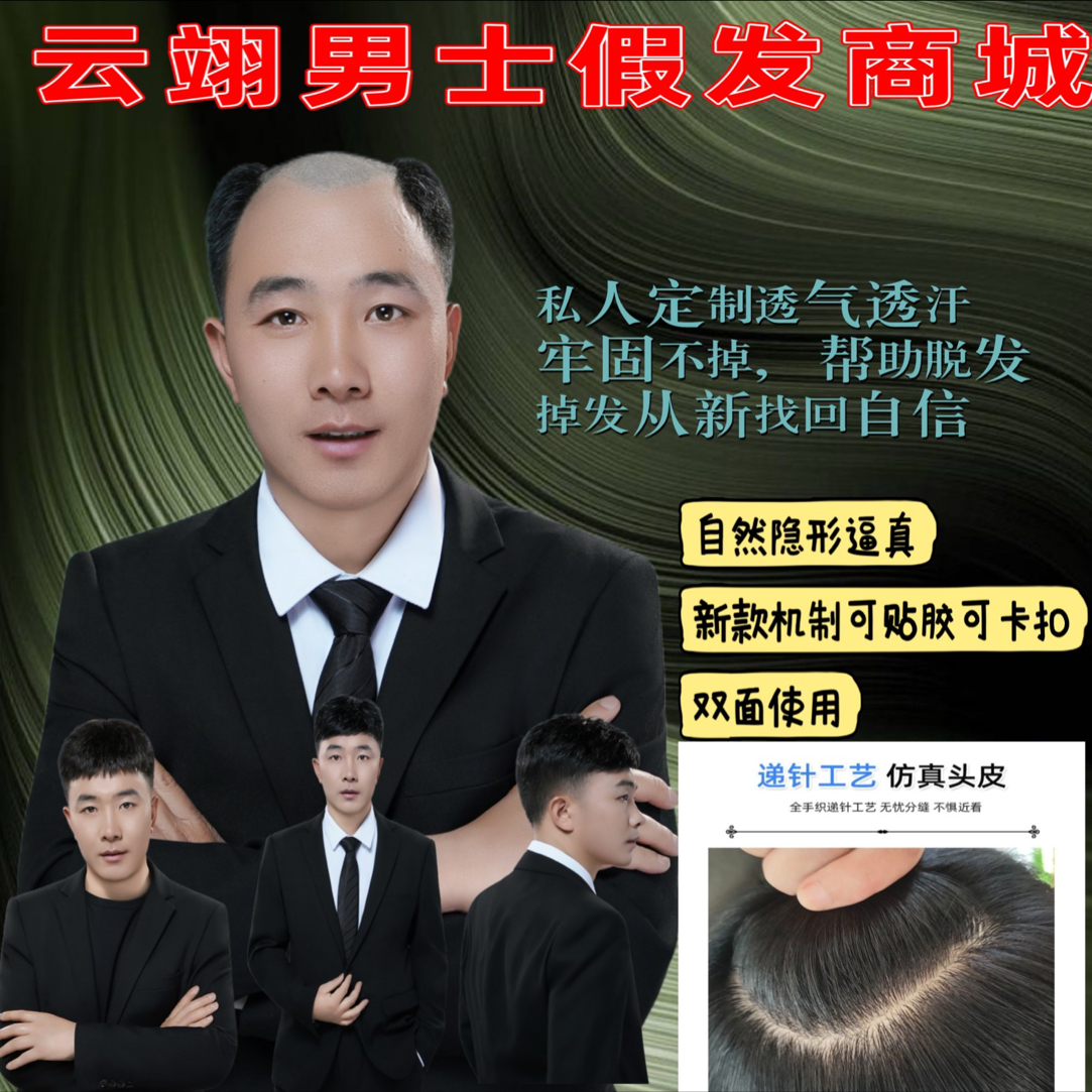 B款【标准隐形发际线+德国沙网全递针头皮】6代生物边中年快捷补发