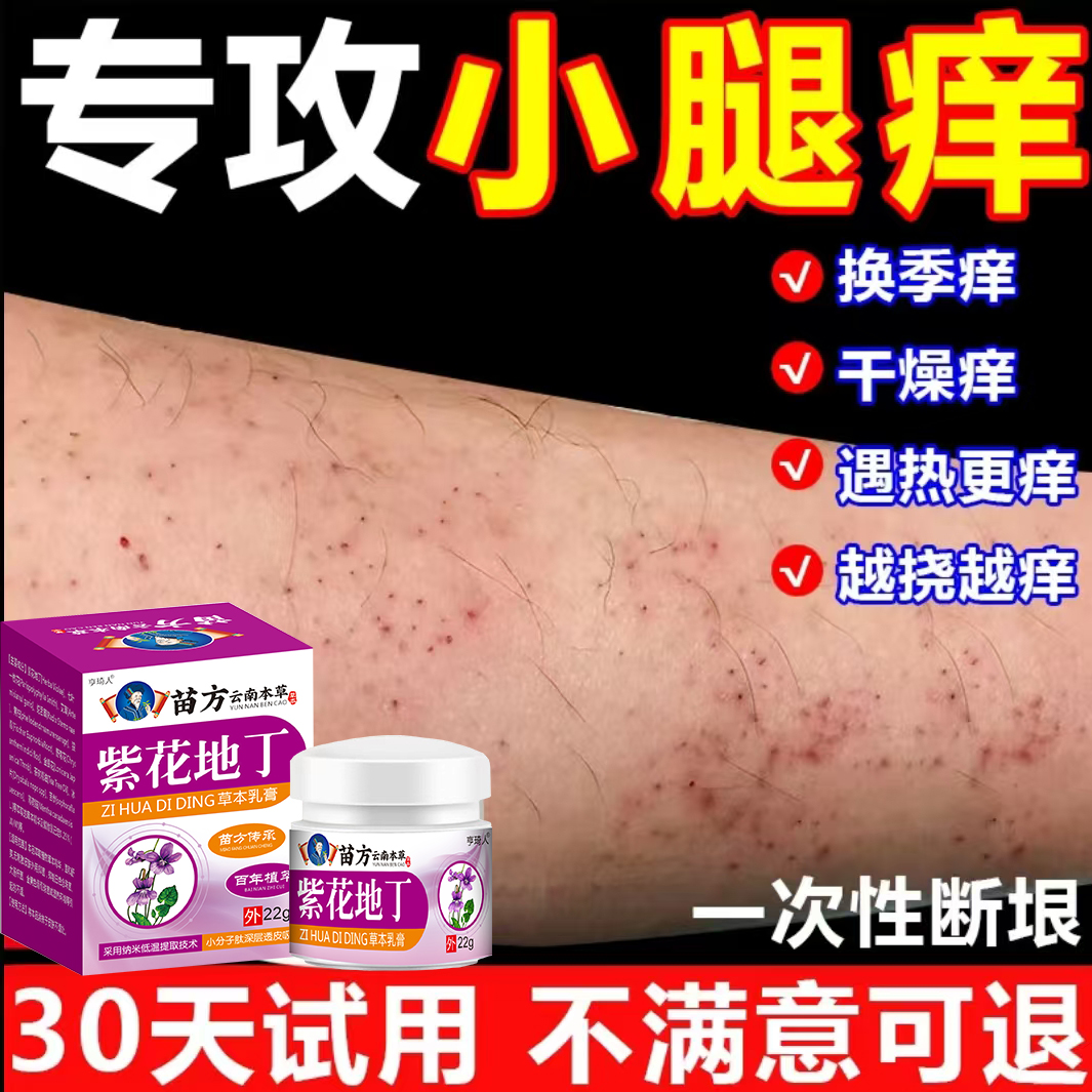 腿上干燥起皮小腿皮肤痒秋冬腿部瘙痒越抓越痒止痒抑菌膏
