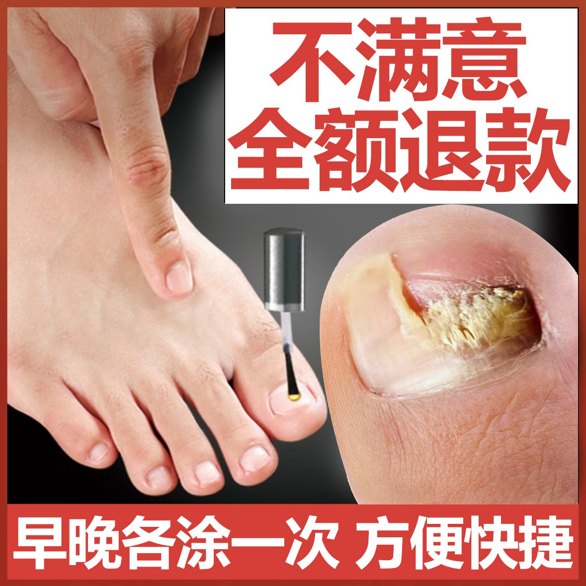 【品牌直销】指甲护理空/厚/变色/变脆/手脚甲通用套装-按套餐拍