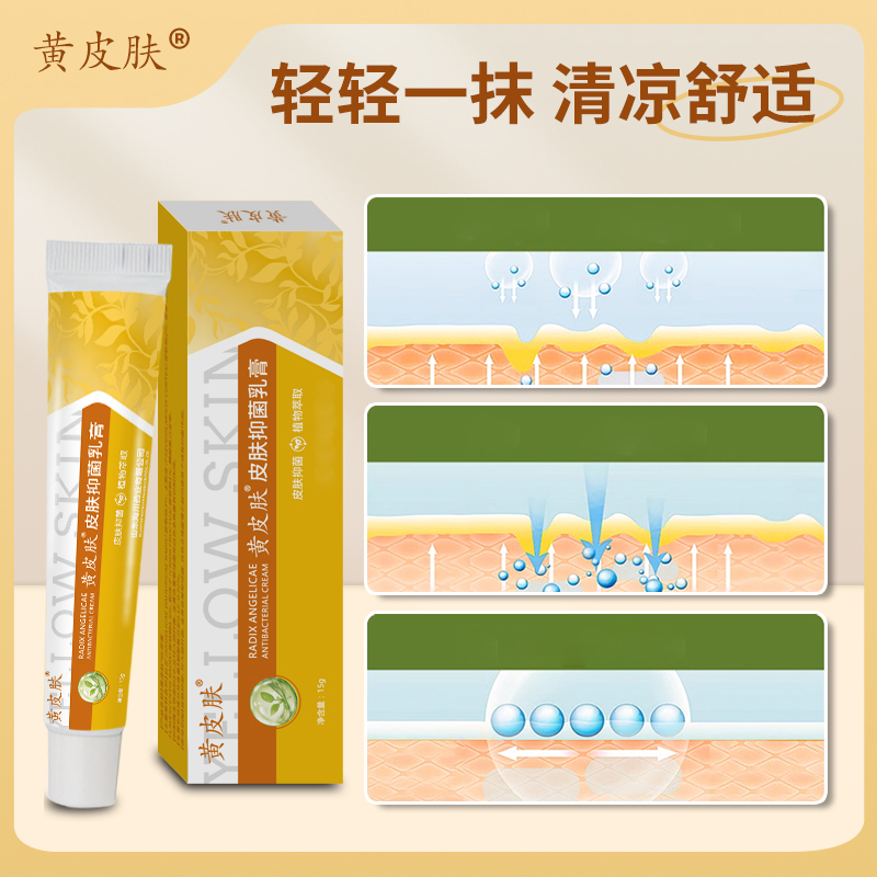 黄皮肤【新品上架 数量有限】皮肤抑菌乳膏  男女老少皆宜