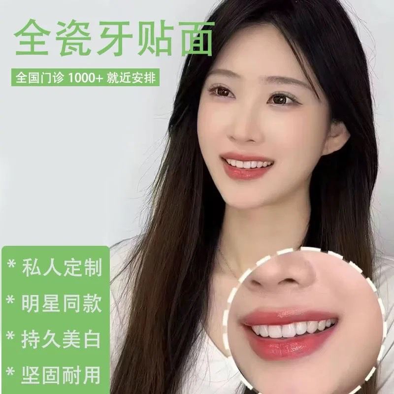 超薄明星同款全瓷牙贴贴