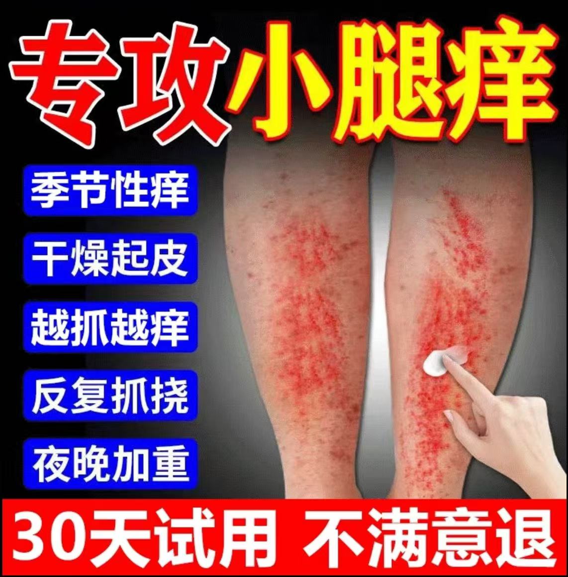 腿上干燥起皮小腿皮肤痒秋冬腿部瘙痒越抓越痒止痒抑菌膏