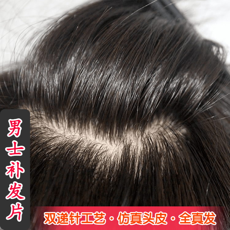 男士假发真发补发片高档透气短发全手织秃顶头顶发际线新款补发块