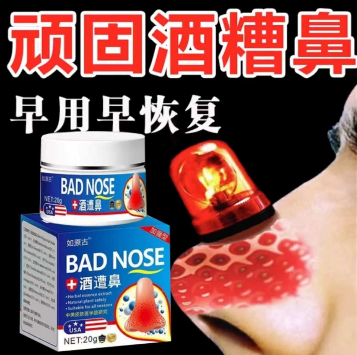 鼻头酒渣鼻去螨虫鼻红鼻子专用】红血丝粉刺特效软膏草莓鼻大鼻子