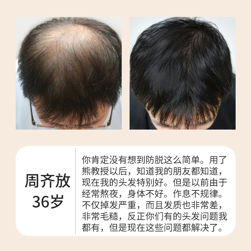 防脱洗发液对头发的效果展示