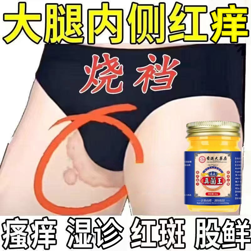 【香港老品牌】大腿内侧红斑痒烧裆湿痒红疹股鲜起皮止痒膏身体护理