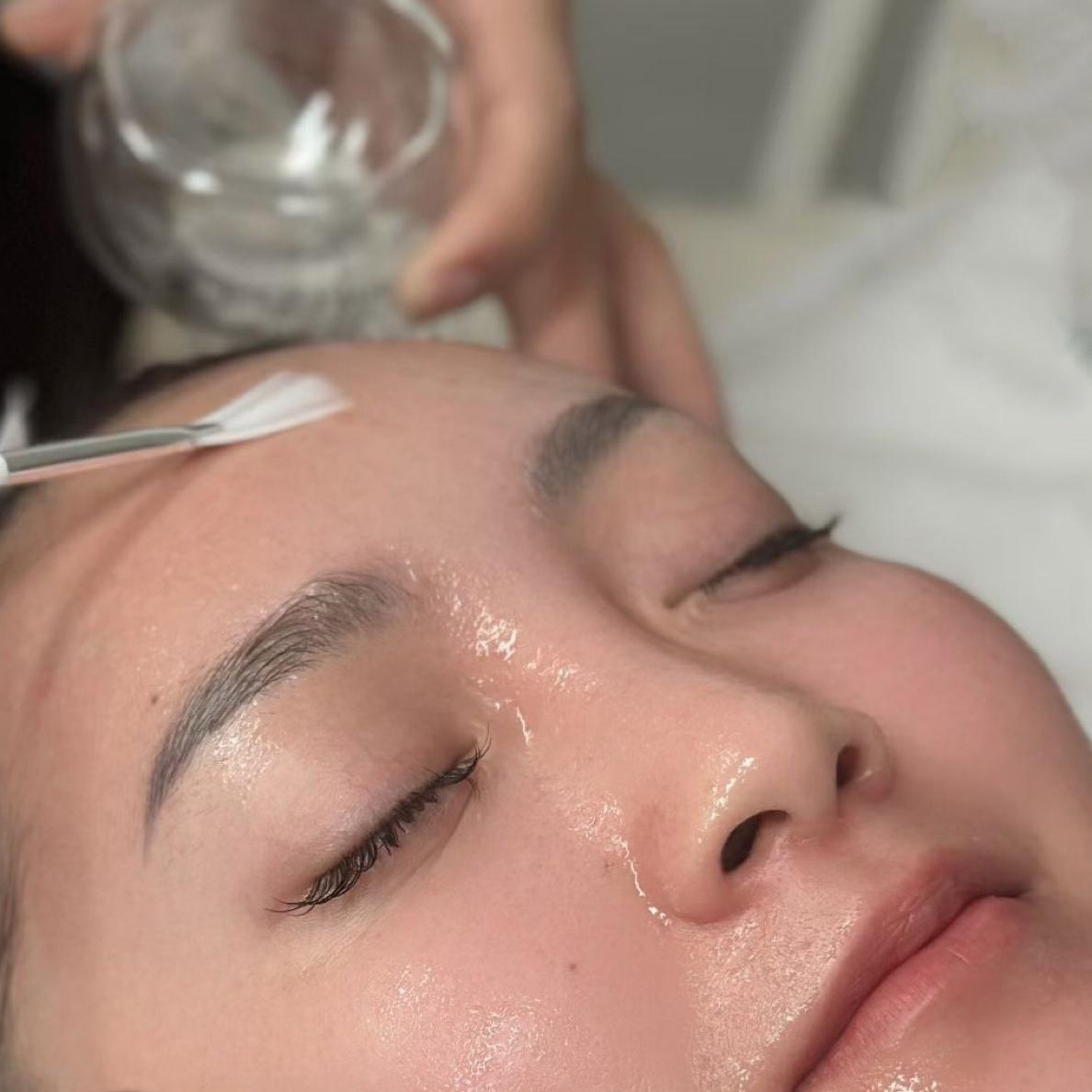 【瑞士院线升级2.0】水光➕刷酶➕刷菌，紧致透亮细腻水光蛋白酶液 5ml