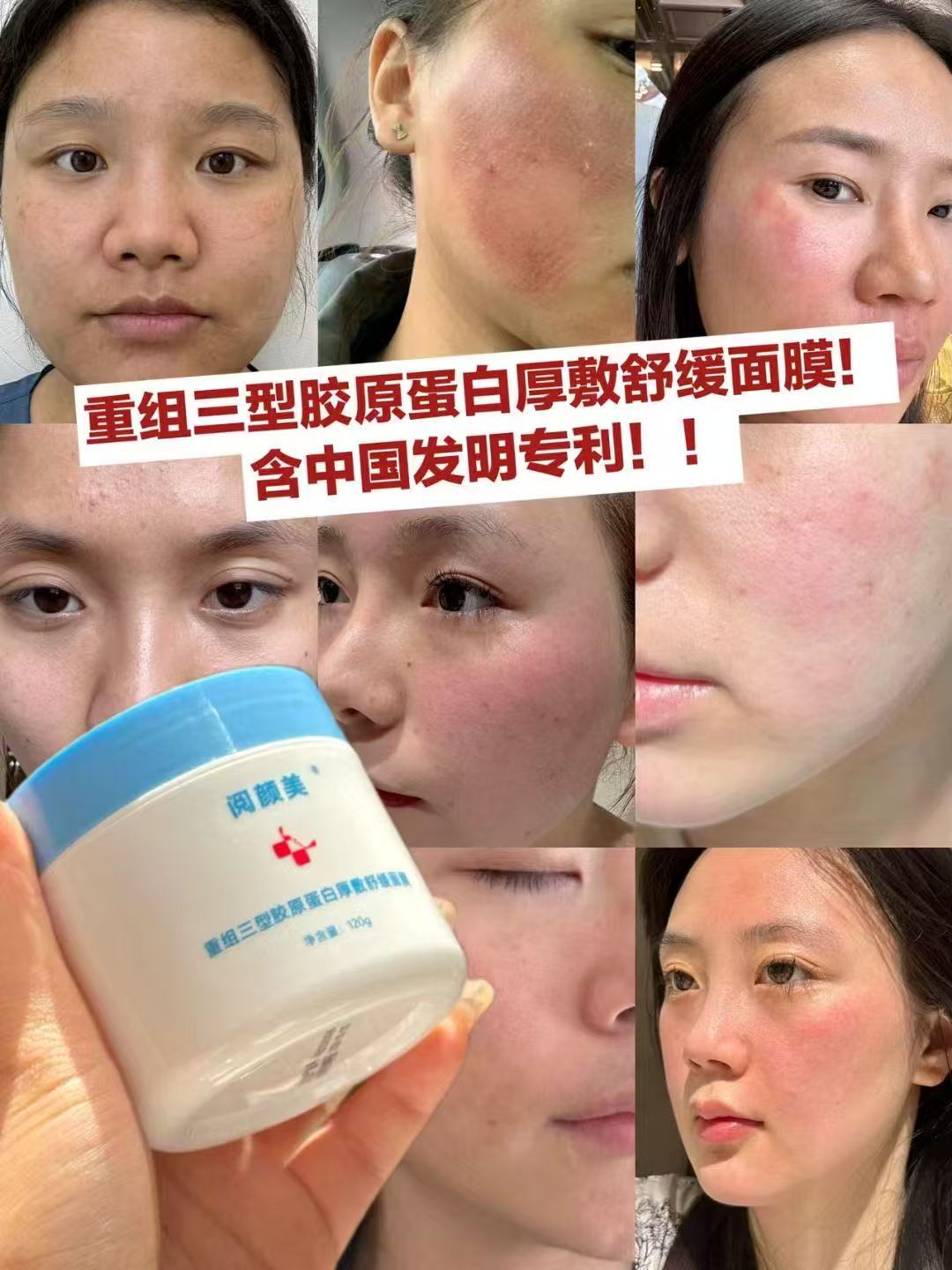 重组三型跤原蛋白厚數面膜s