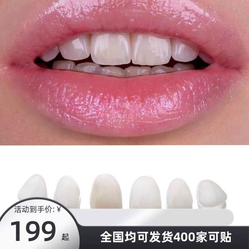 全瓷超薄牙贴贴 明星同款1颗