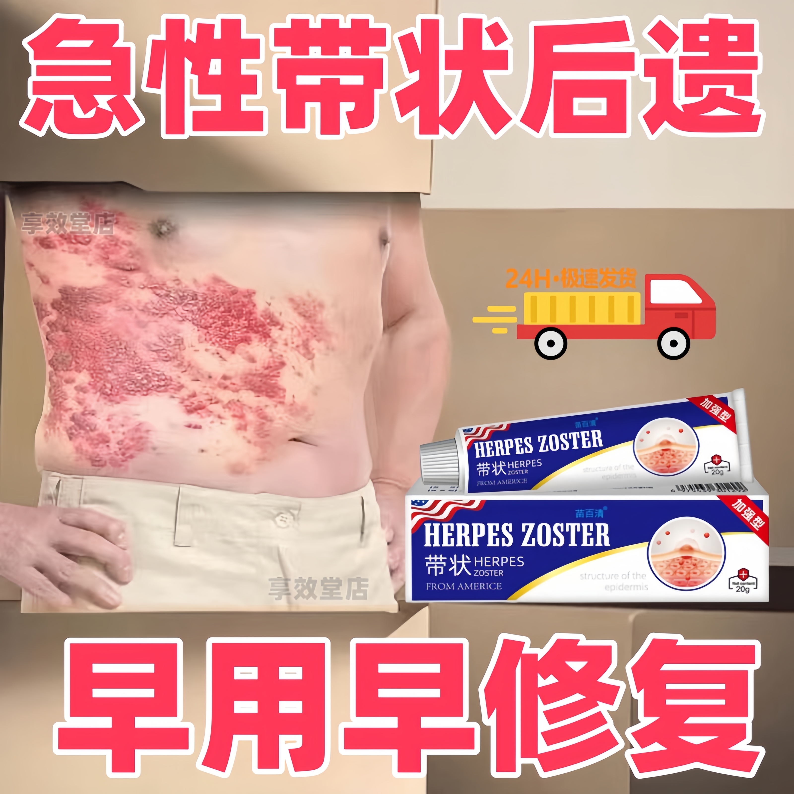 带状泡疹后遗神经痛特效葯专用膏蛇盘疮疱疹清病毒缠腰龙蛇胆疮膏