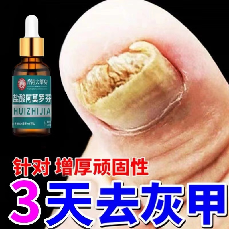 【官方正品】手脚指甲脚指甲增厚叠层发灰发黄变色指甲渗透抑菌液