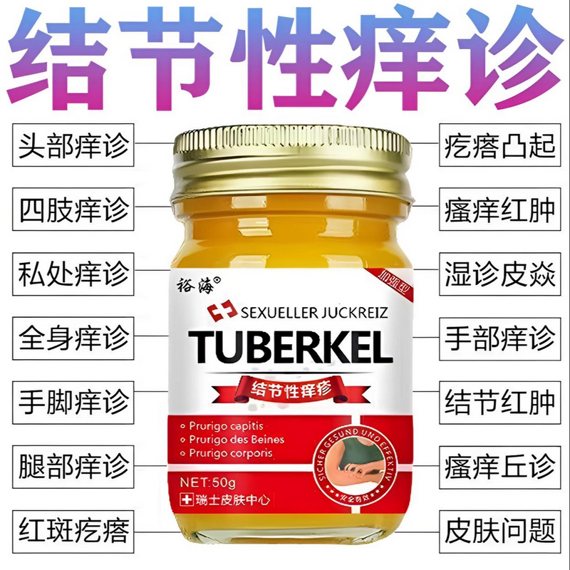 结节性痒珍膏硬块结痂红斑全身止痒去硬疙瘩寻麻诊湿诊外用涂抹膏
