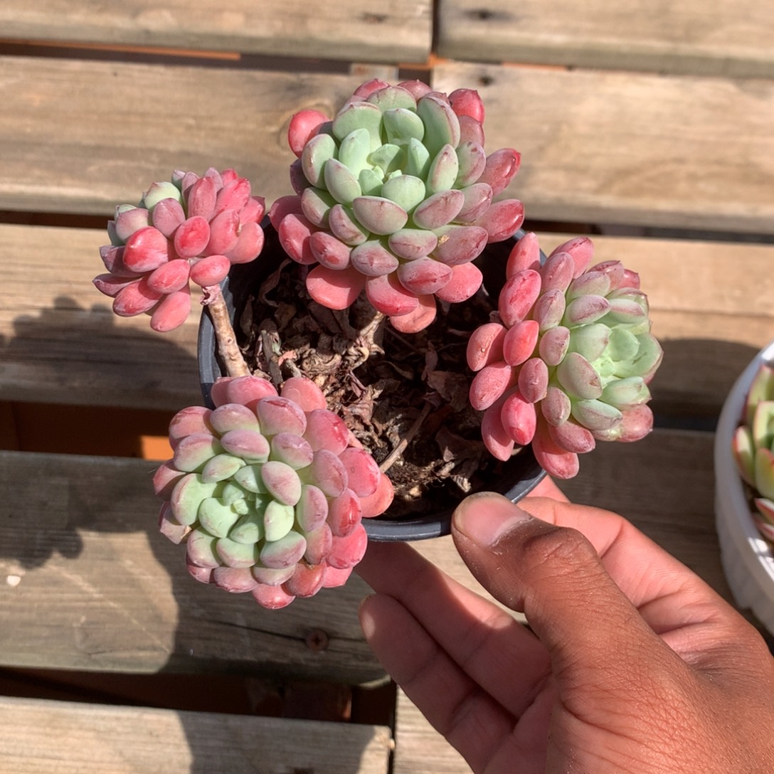 那时候是在医院做护理