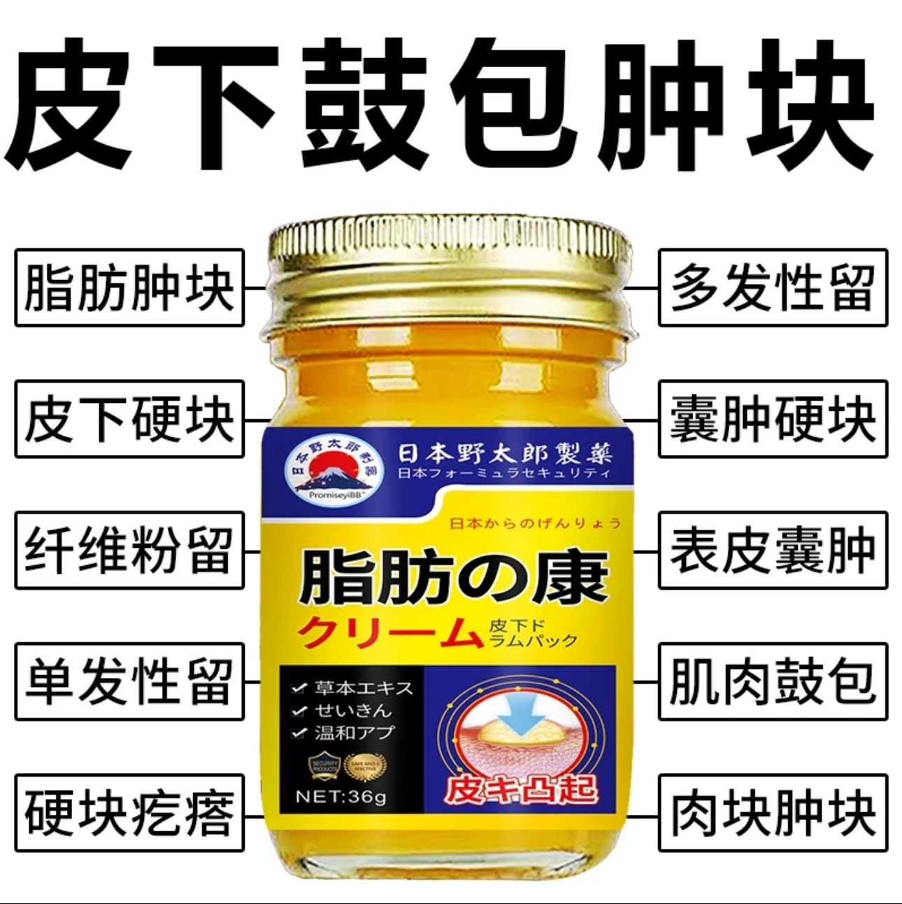 日本脂肪康正品肿块脂肪灵留膏皮下硬块单发性脂肪粒去除身体乳
