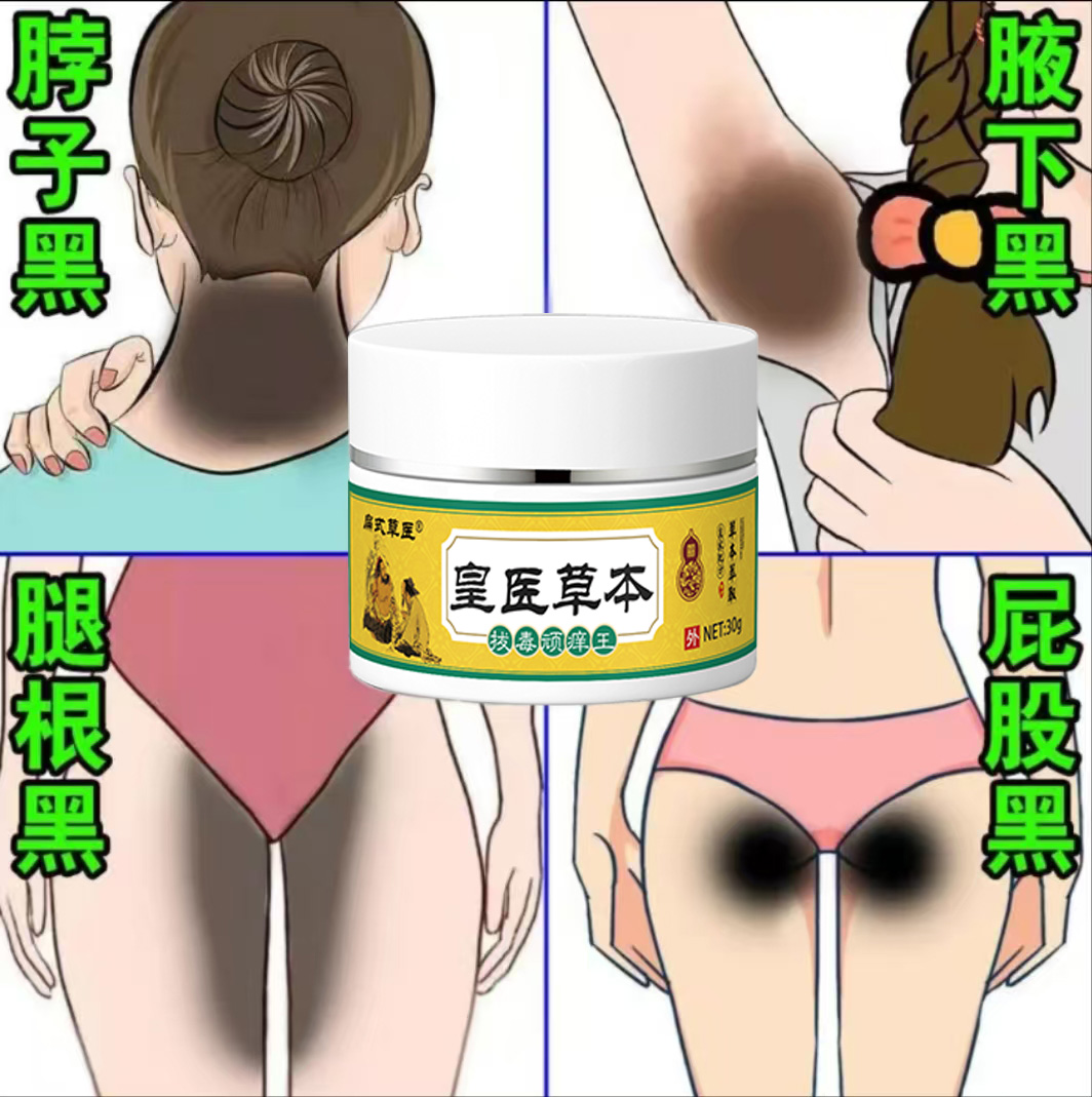 脖子黑棘皮去除神器淡化久坐屁股黑全身关节黑色素沉淀草本乳膏