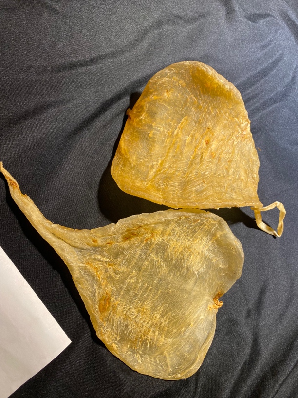 老柔肉斗湖鱼胶2个