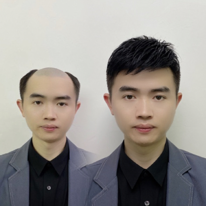 （瑞士网 ）发际线前额漂扣+递针头顶 男士假发片