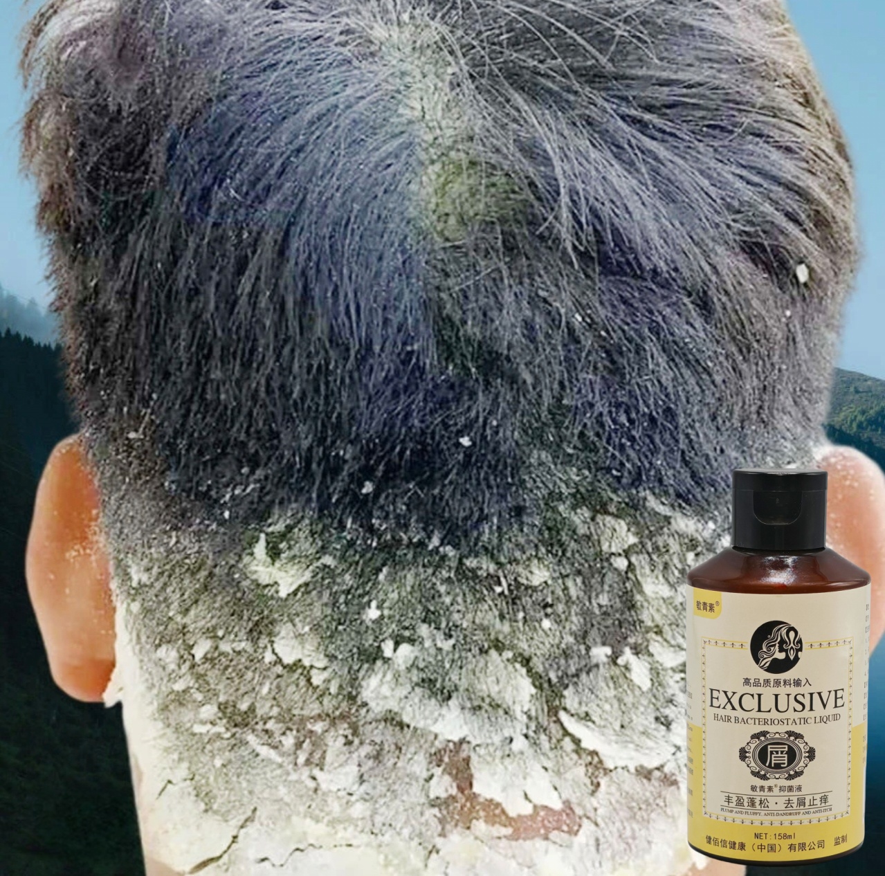 毛囊修复头皮清洁护理洗发水抑菌止痒清凉洗发剂学生去屑丰盈蓬松