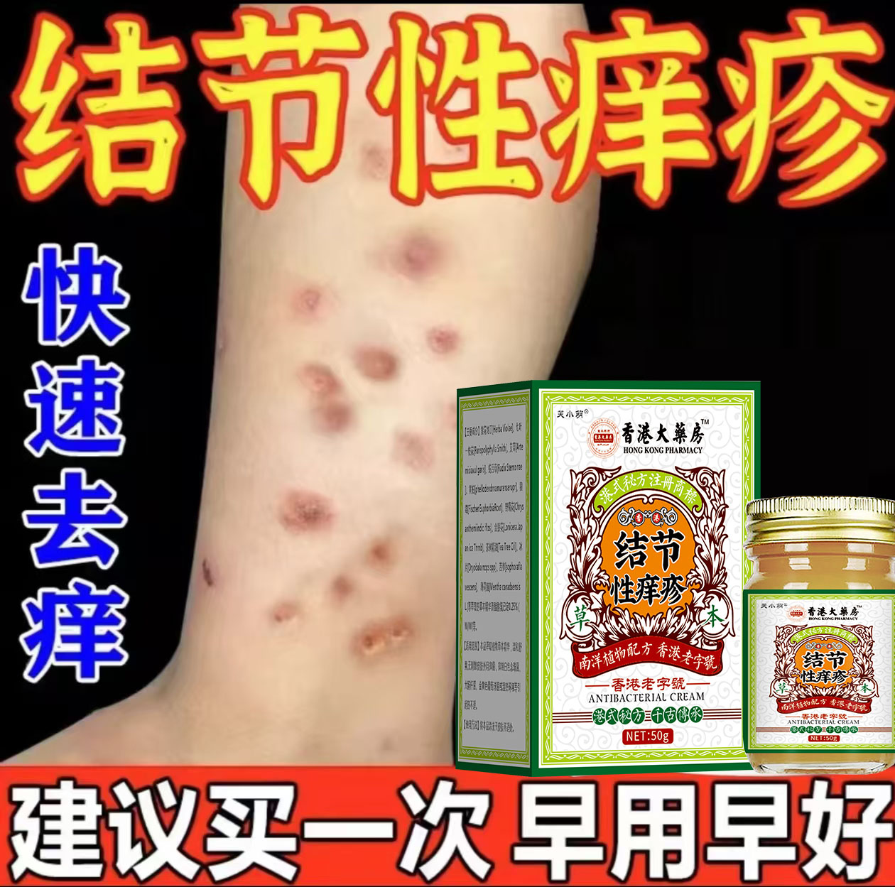 结节性痒疹止痒特效进口去硬疙瘩结咔苔癣皮焱湿诊顽固性皮肤外用