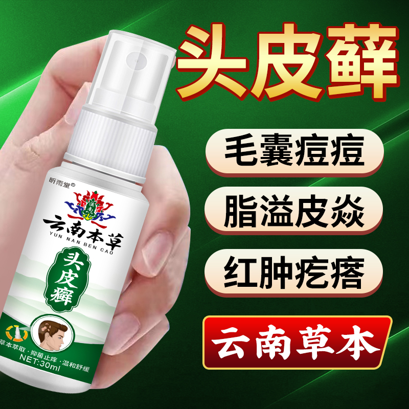 【云南本草】头藓喷剂头皮瘙痒结痂大块白色头皮屑头痒疙瘩头皮外用