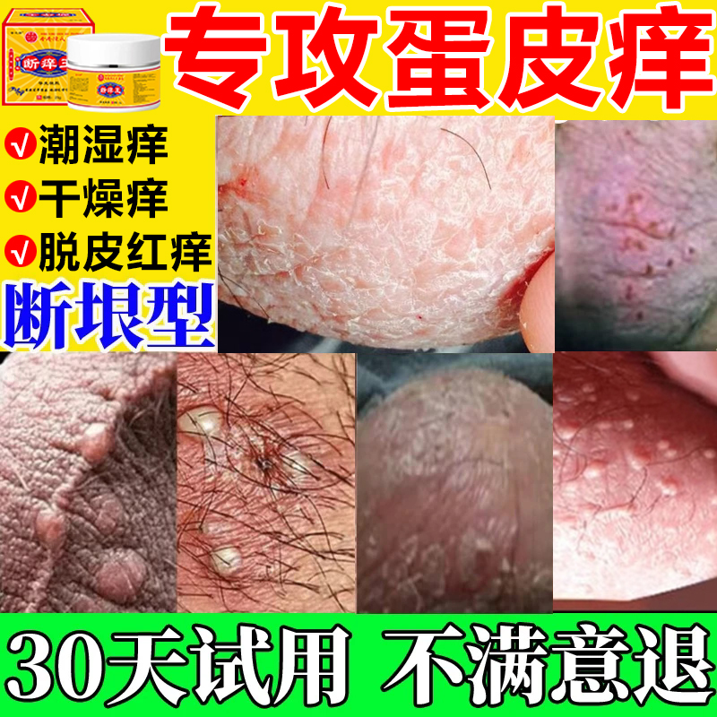 男人私处蛋蛋痒阴部潮湿下体大腿内侧痒起乌龟皮疙瘩痒抑菌止痒膏