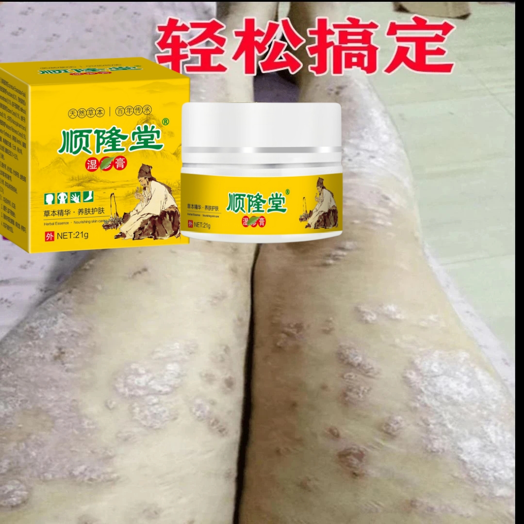 【爷爷的老方子】顽固皮肤湿痒快速止痒草本抑菌止痒膏外用全身可用