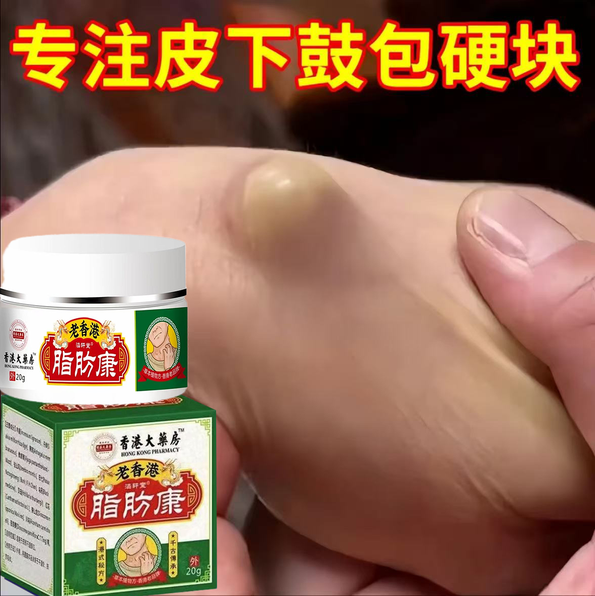 脂肪康正品膏脂肪灵膏皮下硬块凸起单发性多发性涂皮肤抹膏