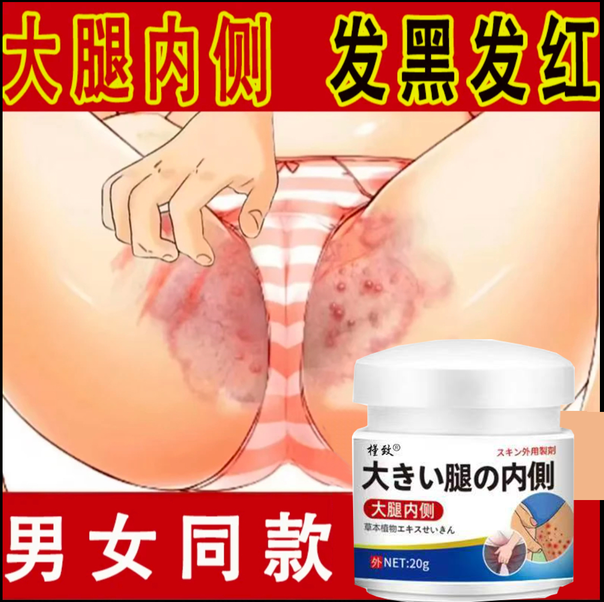 大腿内侧阴囊湿痒异味难闻越抓越痒男女同款全身可用草本抑菌软膏
