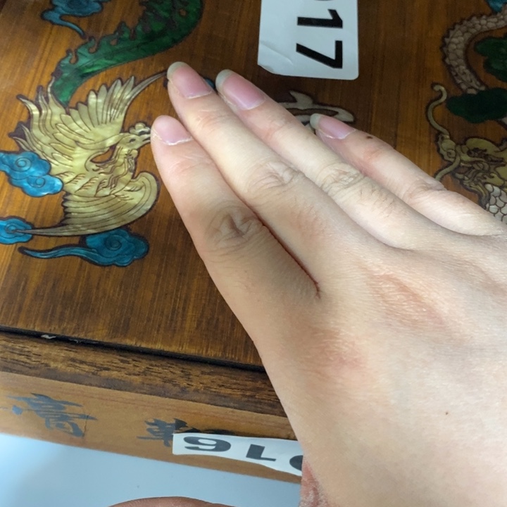 紫砂——————————————————-