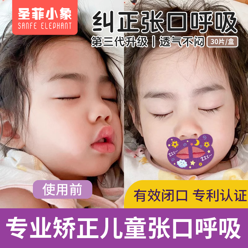 口呼吸矫正贴闭口嘴贴睡觉防张嘴神器嘴巴封口贴成人嘴唇闭合儿童