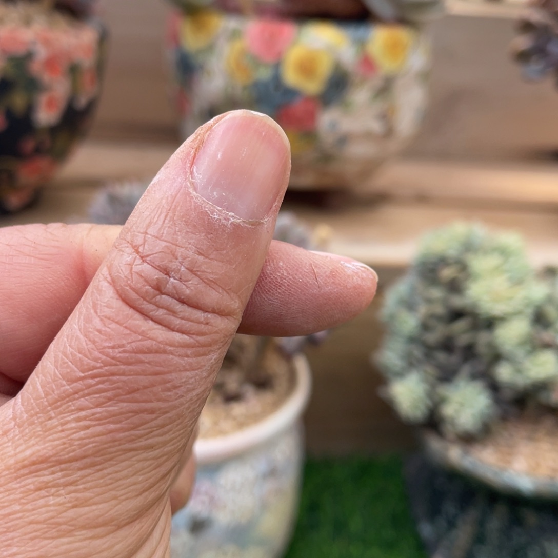 孩***儿嫁接娃娃锦群孩儿的