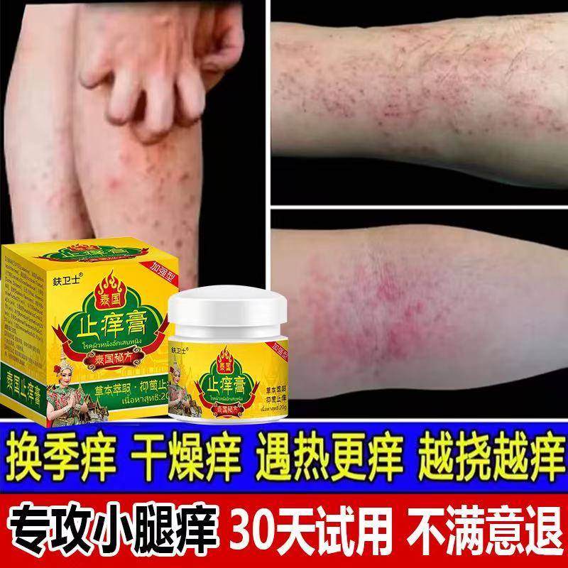 【专攻小腿痒】泰国止痒膏夏秋小腿皮肤痒季节性脚上有红点起皮草本