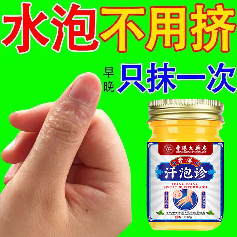 手上起小水泡外用涂抹手指手缝红痒渗液脱皮止痒清凉护理草本乳膏