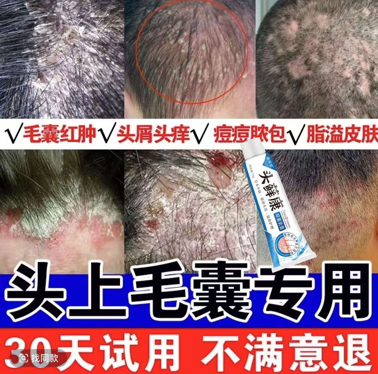 头鲜头部痒毛囊疙瘩头皮止痒抑菌草本外用乳膏