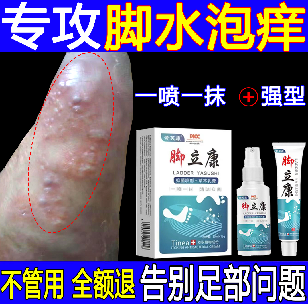 脚底脚上起小水痒泡脱皮真菌王脚臭气止痒抑菌软膏特效神器克星