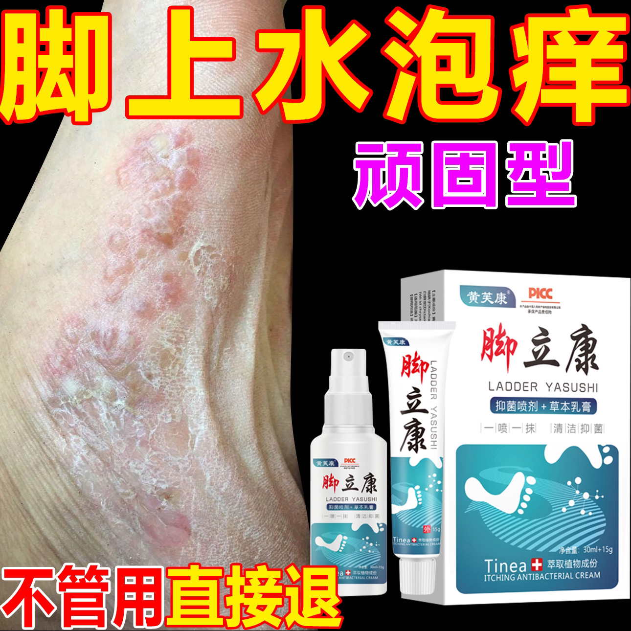 脚底脚上起小水痒泡脱皮真菌王脚臭气止痒抑菌软膏特效神器克星