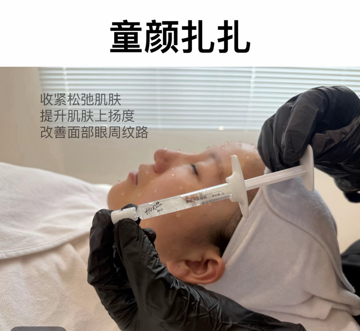 韩国童颜水凝扎扎