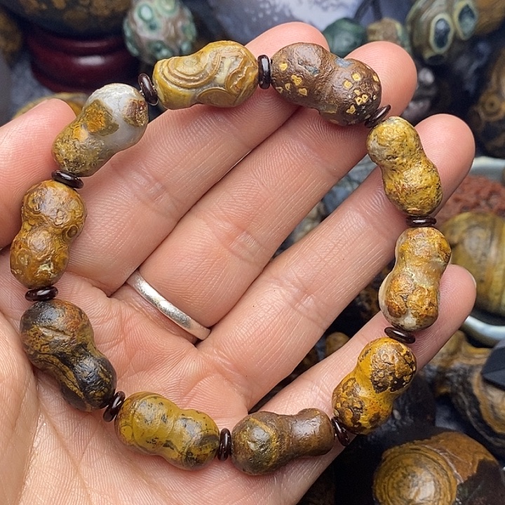 周***一眼睛疼也疼过吗今天你