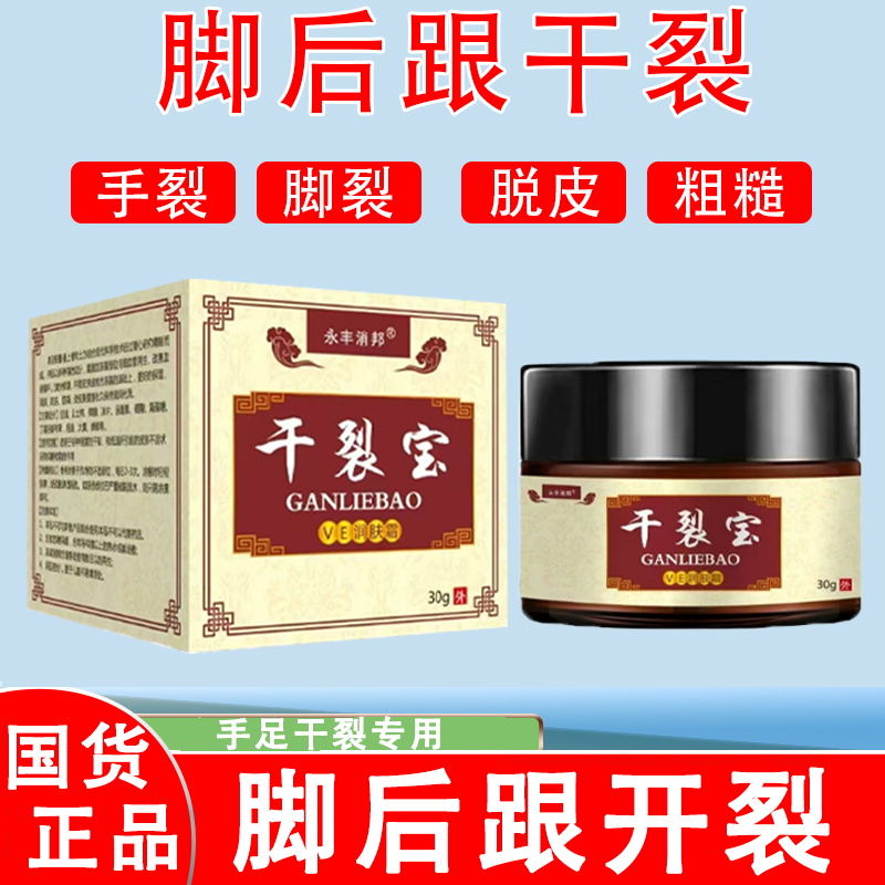 【国货正品】干裂宝防冻防干裂霜手脚干燥开裂脱皮适用手足防裂膏